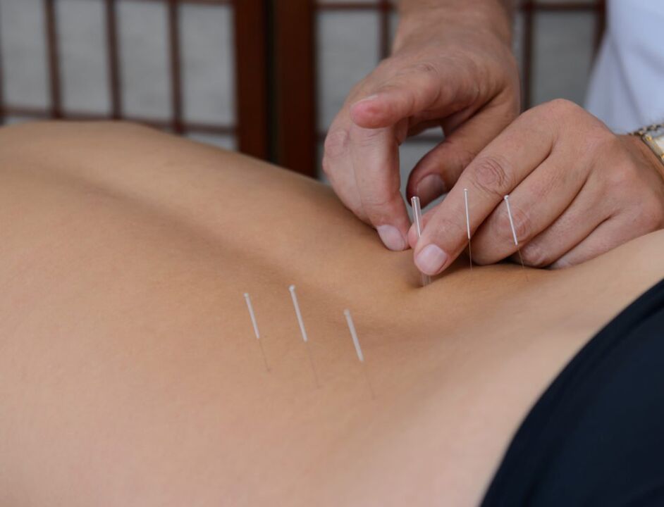 acupuntura para la prostatitis