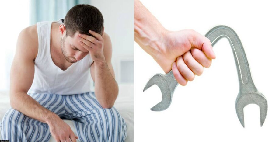 Síntomas de prostatitis