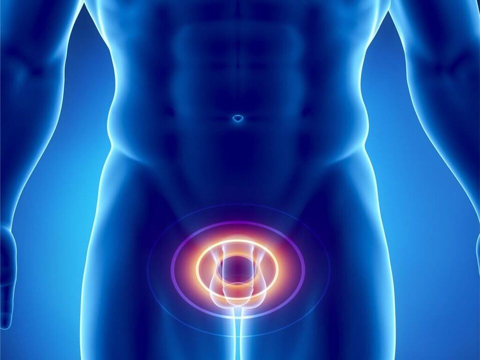 síntomas de prostatitis en hombres